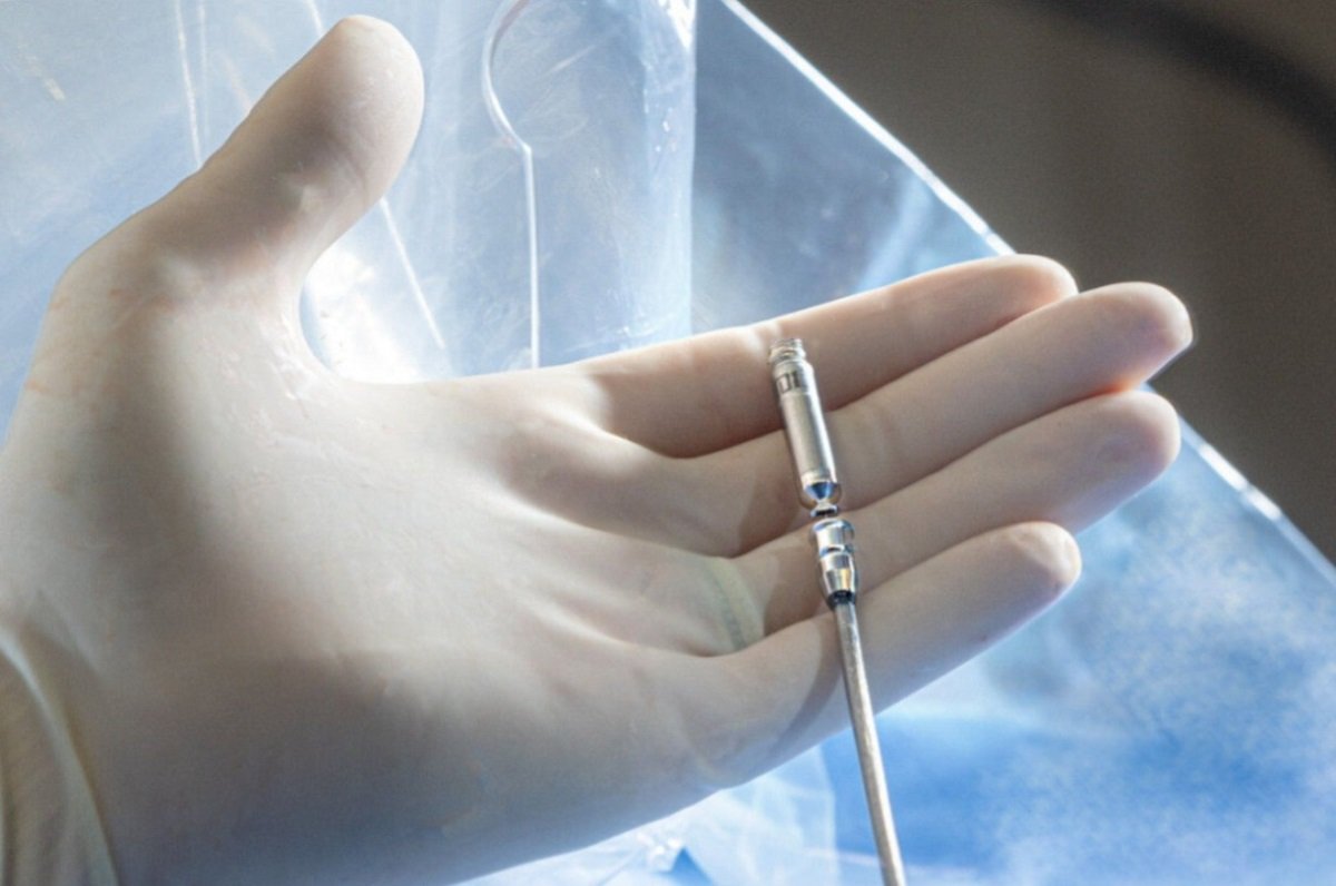 Tripura’s GBP hospital performs first leadless pacemaker implantation ...